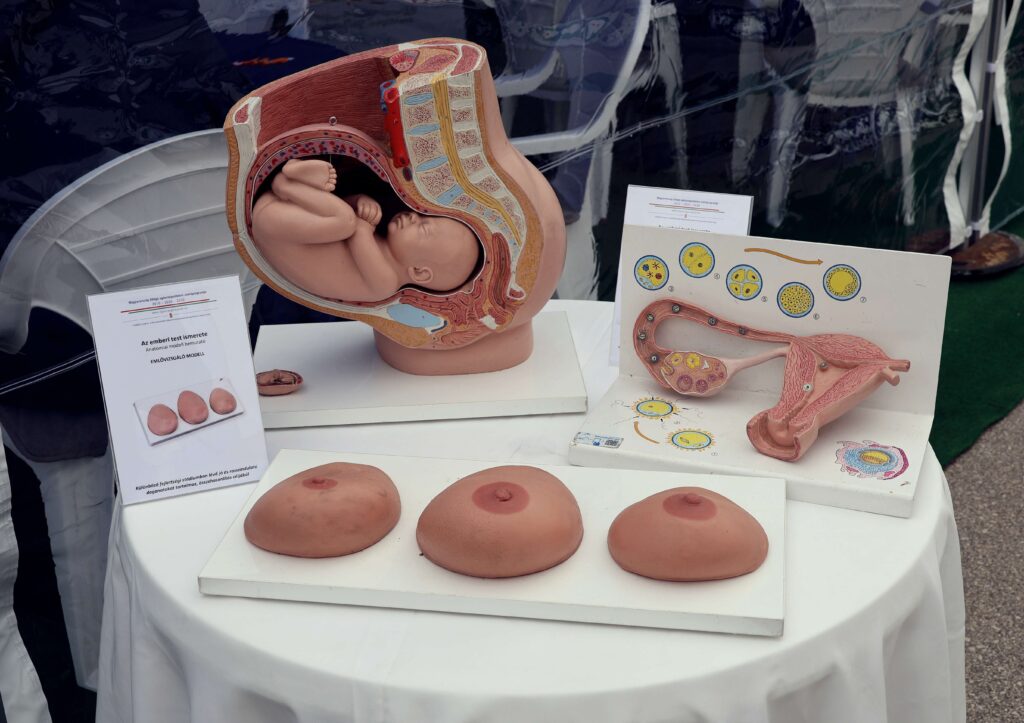 Makóra érkezett a Magyarország átfogó egészségvédelmi szűrőprogramja, és például kardiológiai, szemészeti, fogászati és tüdőgyógyászati vizsgálatokon vehettek részt az érdeklődők. Fotó: Jeszenszky Zoltán